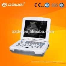 DW-500 / DW-580 portable ultrasound diagnostic system with cheap price ultrasound scanner for sale